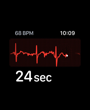 EKG App, Schläge pro Minute in der oberen rechten Ecke, Rhythmuslinie, Timer