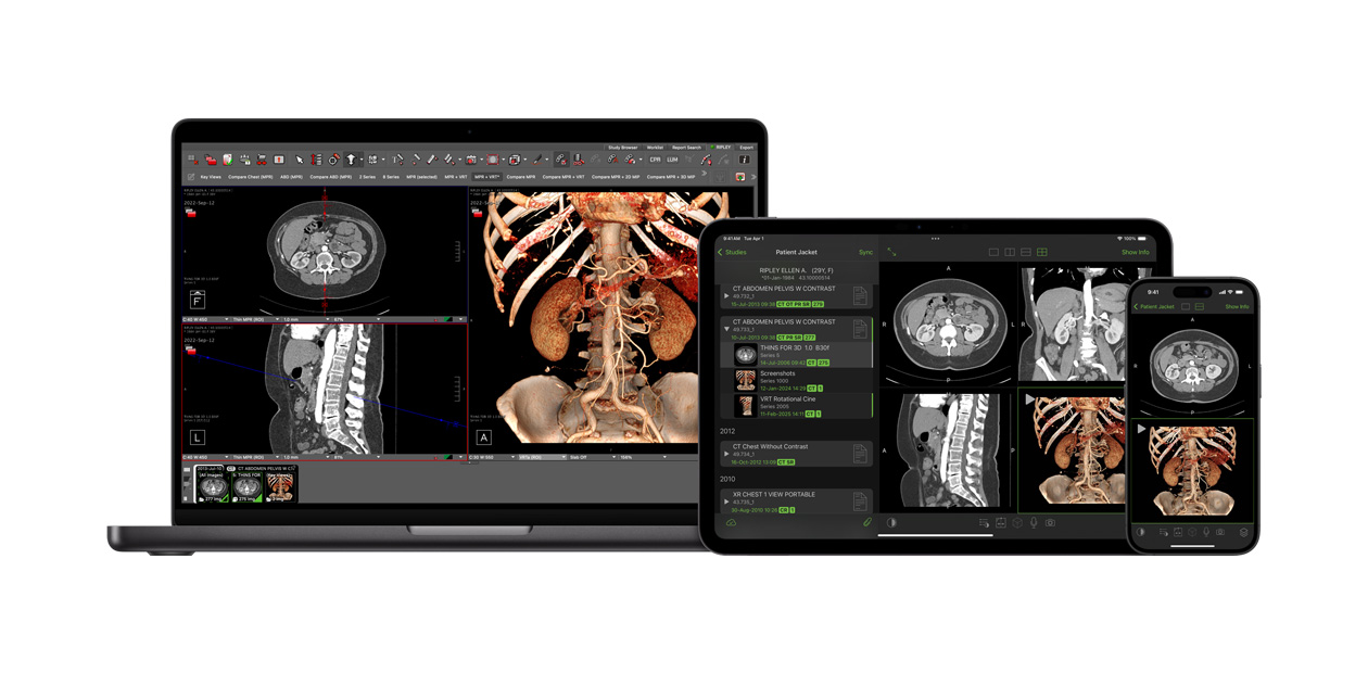 Mjukvara som visar Visage-appen, som radiologer använder för att tolka stora diagnosfiler.