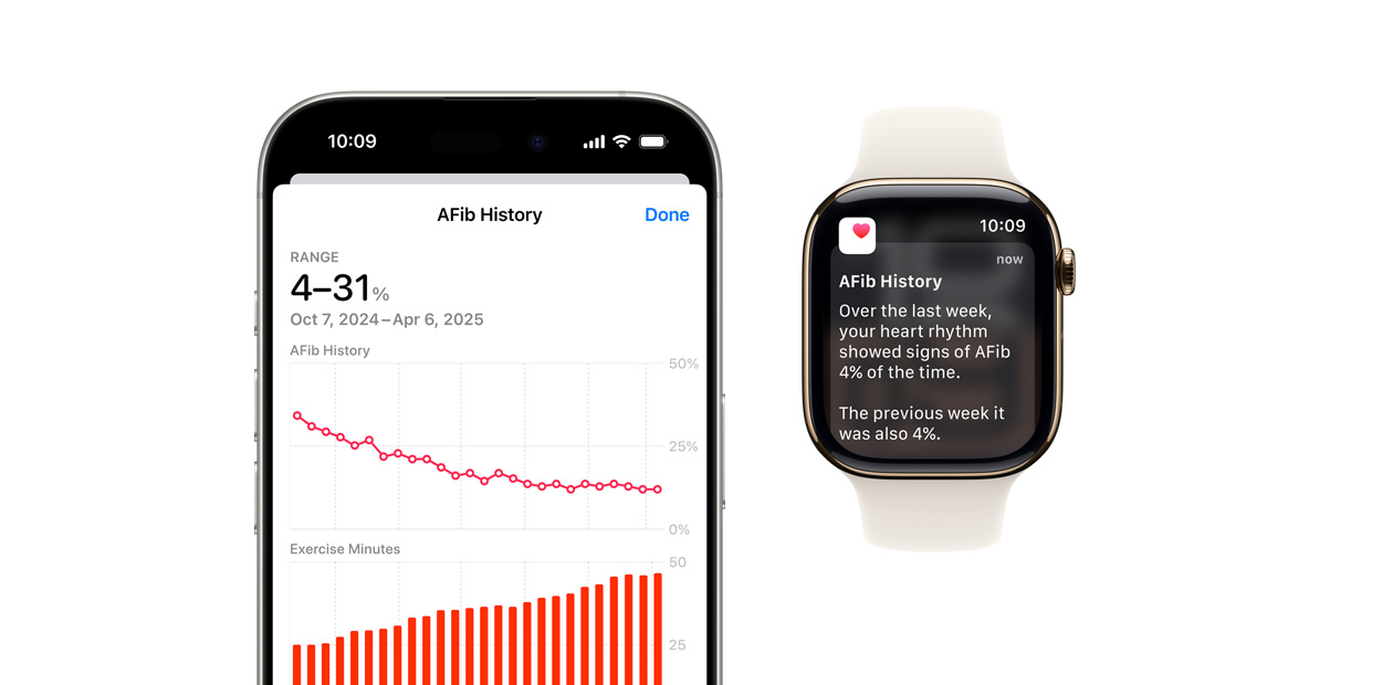 Appen Historik för förmaksflimmer visas på iPhone och notiser visas på Apple Watch.